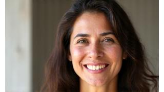 Thumbnail de video testimonio de Carolina F. sobre acné adulto